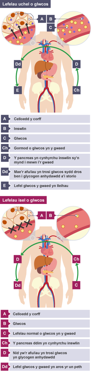 Gormod o glwcos. Pancreas yn gwneud inswlin, corffgelloedd yn amsugno glwcos, lleihau glwcos y gwaed. Lefelau normal, pancreas ddim yn gwneud inswlin, amsugno llai o glwcos, glwcos y gwaed yn gyson.