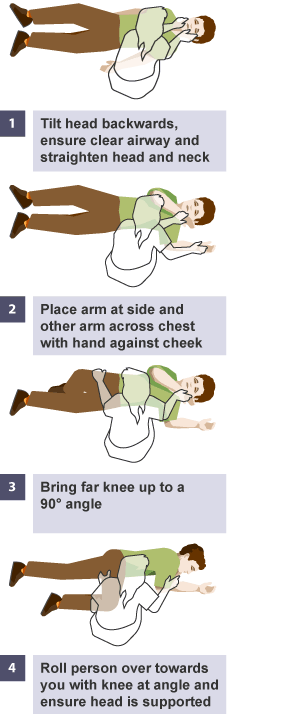 BBC Bitesize - GCSE Physical Education - Signs, symptoms and treatment ...