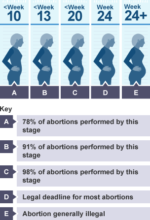 is bitesize important exercise bbc why Revision Abortion  1 Studies    GCSE BBC Bitesize  Religious