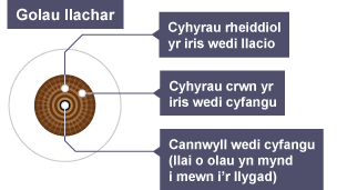 Diagram yn dangos sut mae'r llygad dynol yn adweithio i olau llachar.