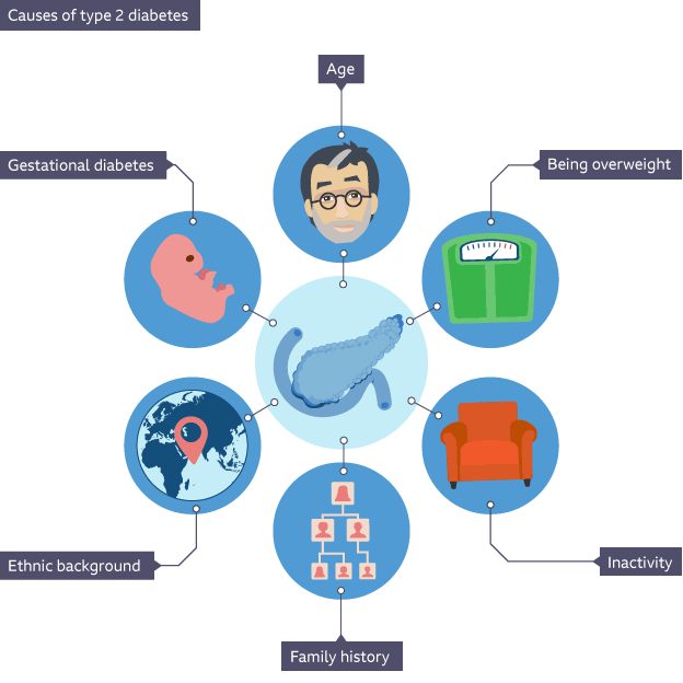 Causes of type 2 diabetes