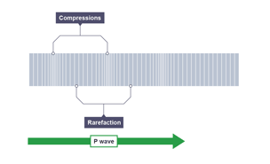 Illustration showing compression and rarefaction on a longitudinal wave