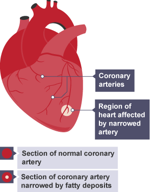 Diagram showing the arteries in and around the heart