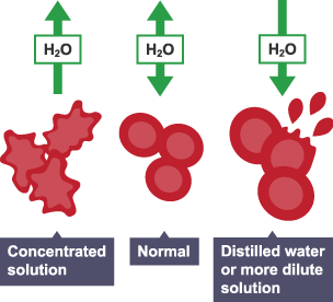 Red blood cells in different solutions