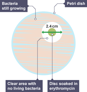 Petri dish showing bacteria growth and its reaction to antibiotic erythromycin