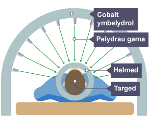 Croestoriad o berson sy'n cael triniaeth am ganser mewn offer radiotherapi. Mae’r diagram wedi'i labelu â Cobalt ymbelydrol, Pelydrau gama, Helmed, a Targed.