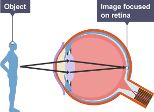 Diagram showing how an image focuses at the retina