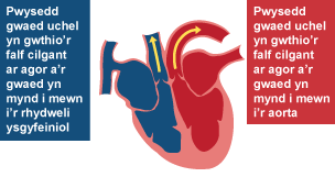Pwysedd gwaed uchel yn gwthio’r falf cilgant ar agor a’r gwaed yn mynd i mewn i’r rhydweli ysgyfeiniol. Pwysedd gwaed uchel yn gwthio’r falf cilgant ar agor a’r gwaed yn mynd i mewn i’r aorta.