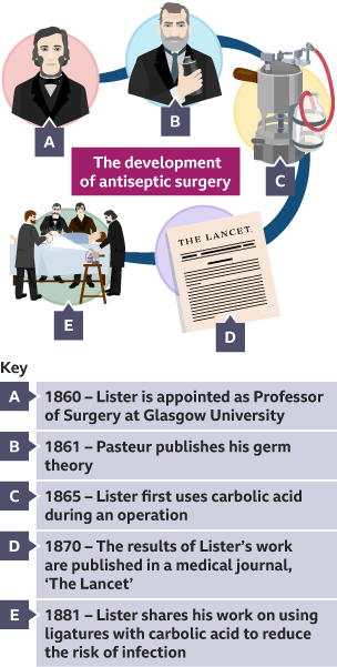 1860 Lister is made Professor of Surgery. 1861 Pasteur publishes his germ theory. 1865 Lister uses carbolic acid. 1870 his findings are published. 1881 shares his work on reducing infection risk.