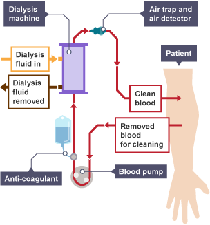 Diagram of a dialysis machine