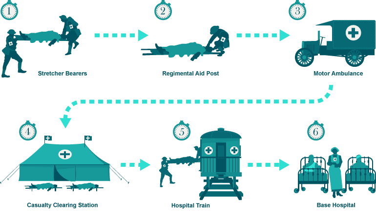 The WW1 medical evacuation pathway for wounded soldiers was complex and sophisticated