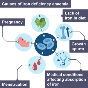 Priority Health Issues – Anaemia