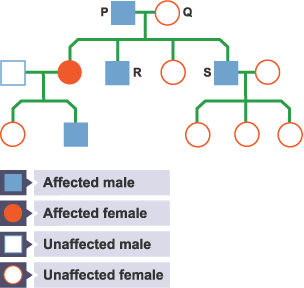 Polydactyly is caused by a dominant allele, D.this shows inheritance of polydactyly in a family.