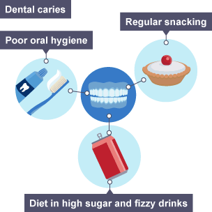 Priority Health Issues – Dental Caries