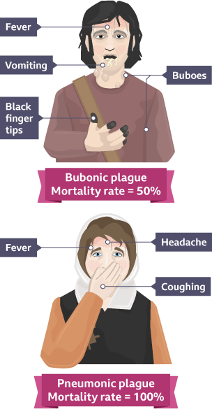 The man on the left with bubonic plague is shown with a fever, black finger tips and is vomiting. Woman on the right has pneumonic plague and is shown with a fever, headache and is coughing