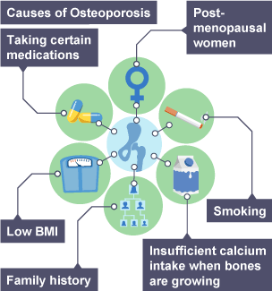 Priority Health Issues – Osteoporosis