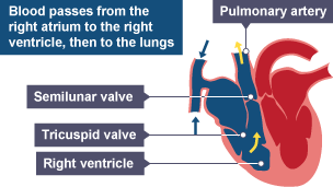 Blood passes from the right atrium to the right ventricle, then to the lungs