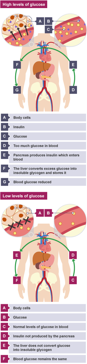 Too much glucose. Pancreas produces insulin, body cells absorb glucose, blood glucose reduced. Normal levels, insulin not produced by pancreas, less glucose absorbed, blood glucose remains same.