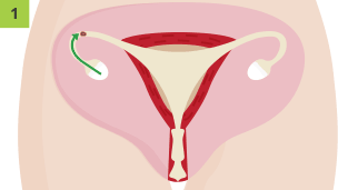 The human female reproductive system working during reproduction and fertilisation. The egg is released from the ovary and moves toward the oviduct.