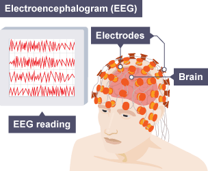 A visual to show how an EEG’s (Electroencephalogram) can observe the electrical activity in the brain.