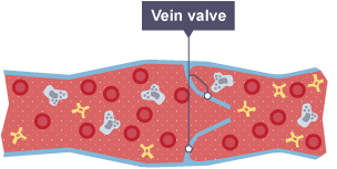 Vien cross section