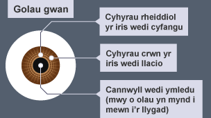 Diagram yn dangos sut mae'r llygad dynol yn adweithio i olau pŵl.