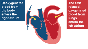 Cross section of the heart showing how deoxygenated blood from the body enters the right atrium. The atria relaxed, oxygenated blood from lungs entres the left atrium