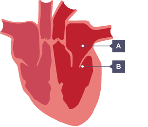 Unlabelled diagram of the heart