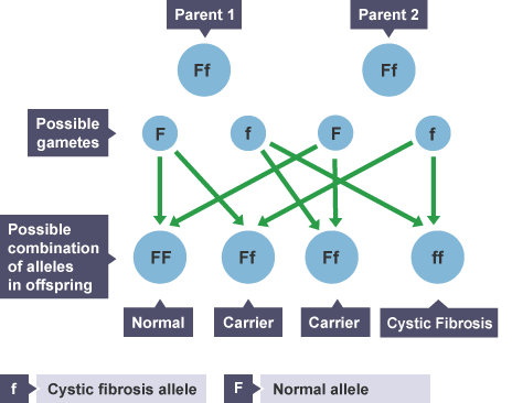 A genetic diagram showing how cystic fibrosis is inherited