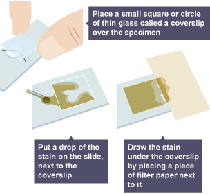 Step by step process of staining cells for examination.