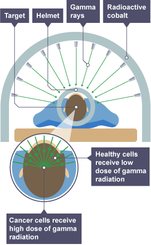 uses of radioactivity in medicine