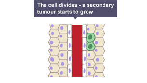 Diagram of how a secondary tumour forms