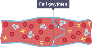 Trawstoriad drwy wythïen yn dangos falf y wythïen.