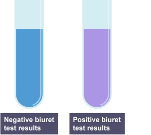 Two test tubes. One contains biuret reagent and is blue in colour. The other contains both biuret reagent and protein and is purple in colour.