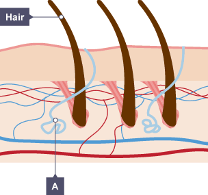 Diagram of a hair follicle and the effect of temperature on it