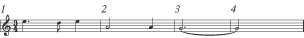 Missing notes. 3/4 time signature with notes missing in each bar.